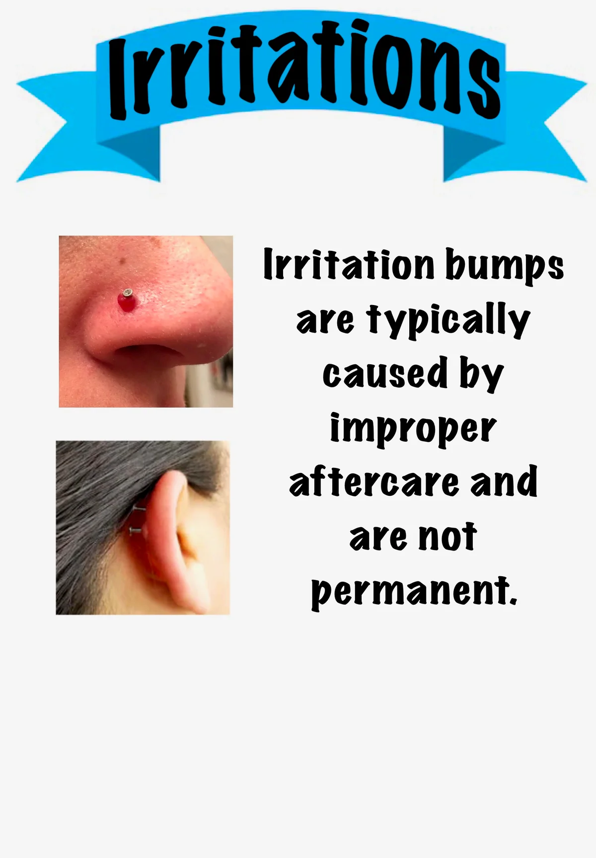 Irritation bumps guide showing causes and treatment